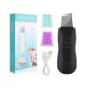 Ultrasonic Facial Cleansing Brush - Deep Cleansing and Blackhead Removal with Vibration Massage - Black